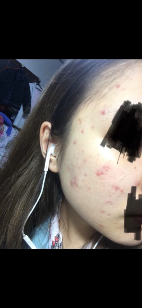 アイきゃち